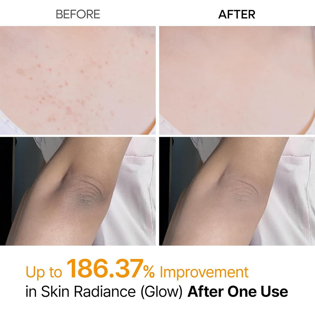 Kojic Acid Body Peeling Turmeric Spray