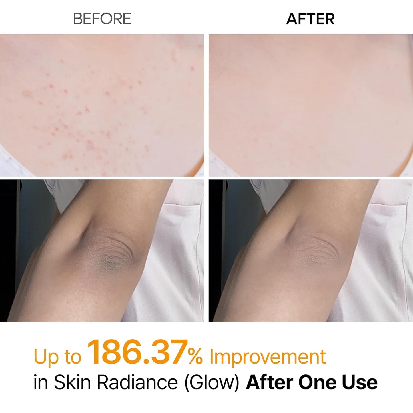 Kojic Acid Body Peeling Turmeric Spray