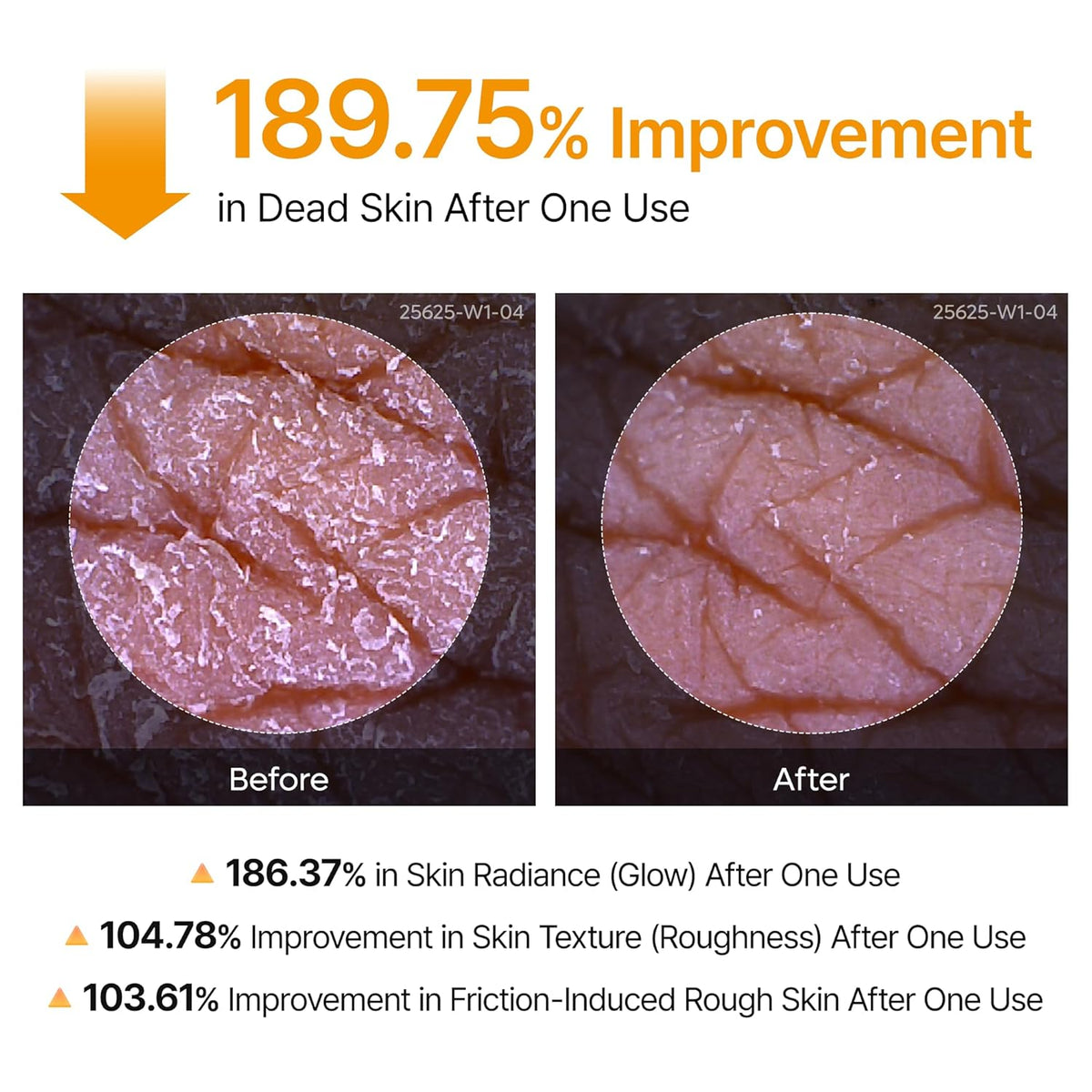 Kojic Acid Body Peeling Turmeric Spray