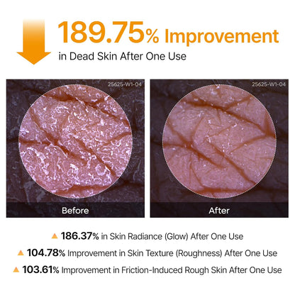 Kojic Acid Body Peeling Turmeric Spray
